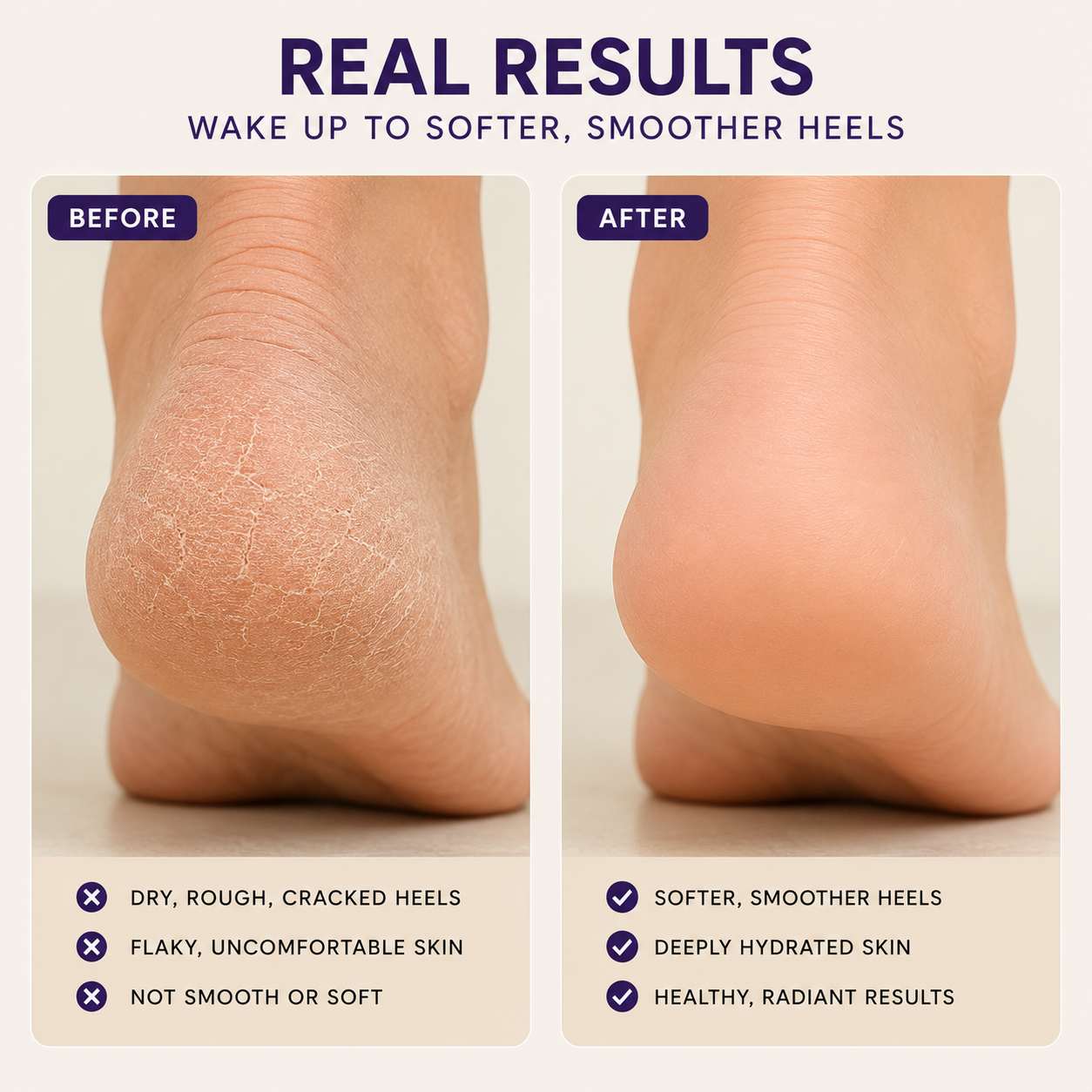 ALUM Shea Butter Heel Repair Patch