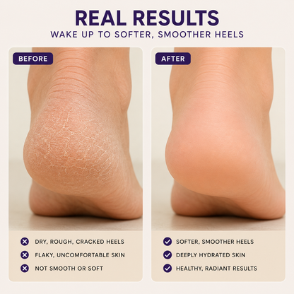 ALUM Shea Butter Heel Repair Patch